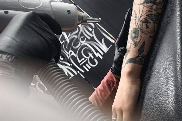 Tattoo verwijderen in Eindhoven