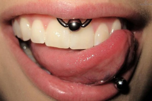 smiley piercing verzorgen