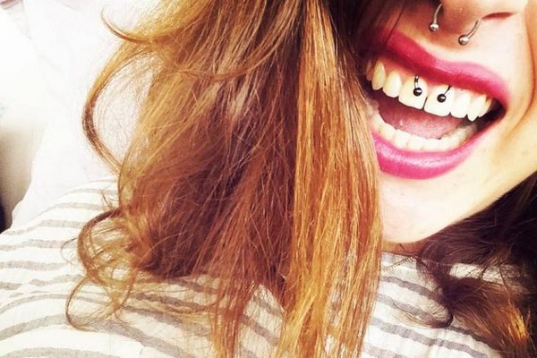 smiley piercing verzorgen