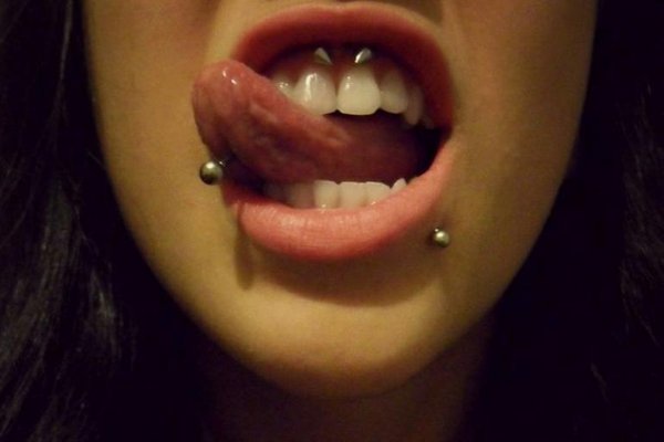 smiley piercing verzorgen