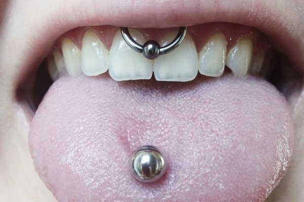 smiley piercing verzorgen