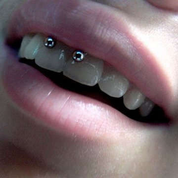 smiley piercing verzorgen
