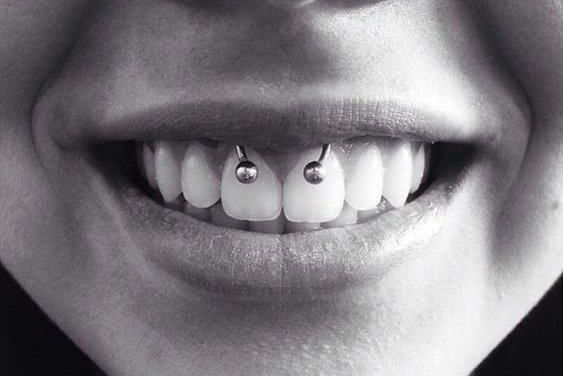 smiley piercing verzorgen